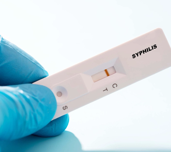 Treatment for Syphilis