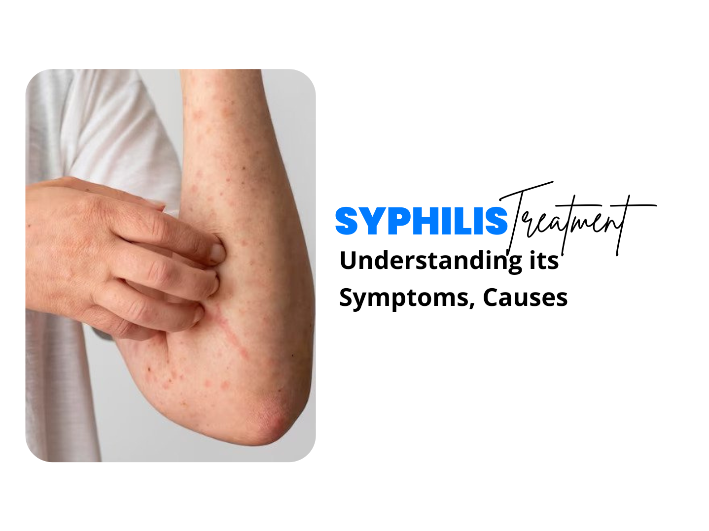 Syphilis: Understanding its Symptoms, Causes, Diagnosis, and Treatment